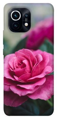 Чехол itsPrint Роза в саду для Xiaomi Mi 11